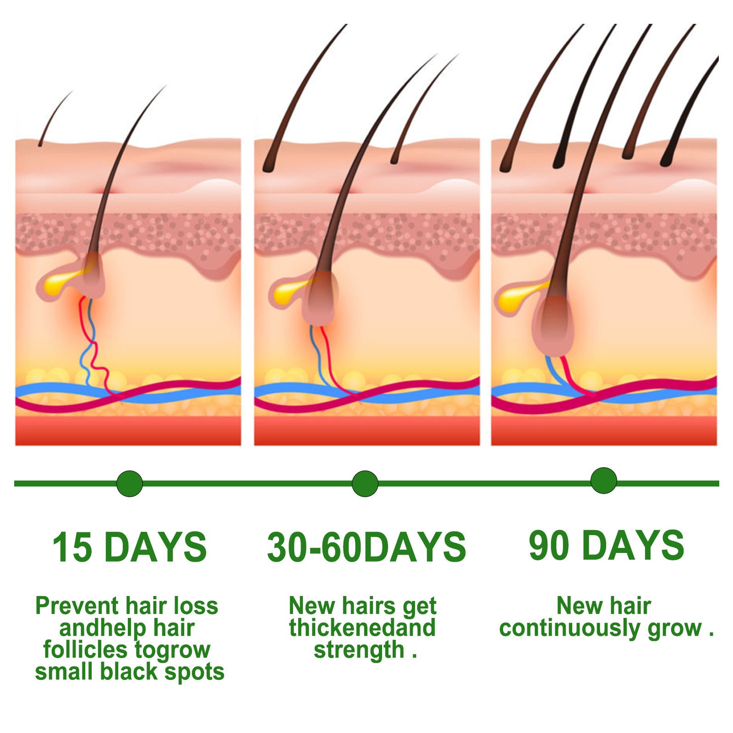 Rosemary Hair Growth